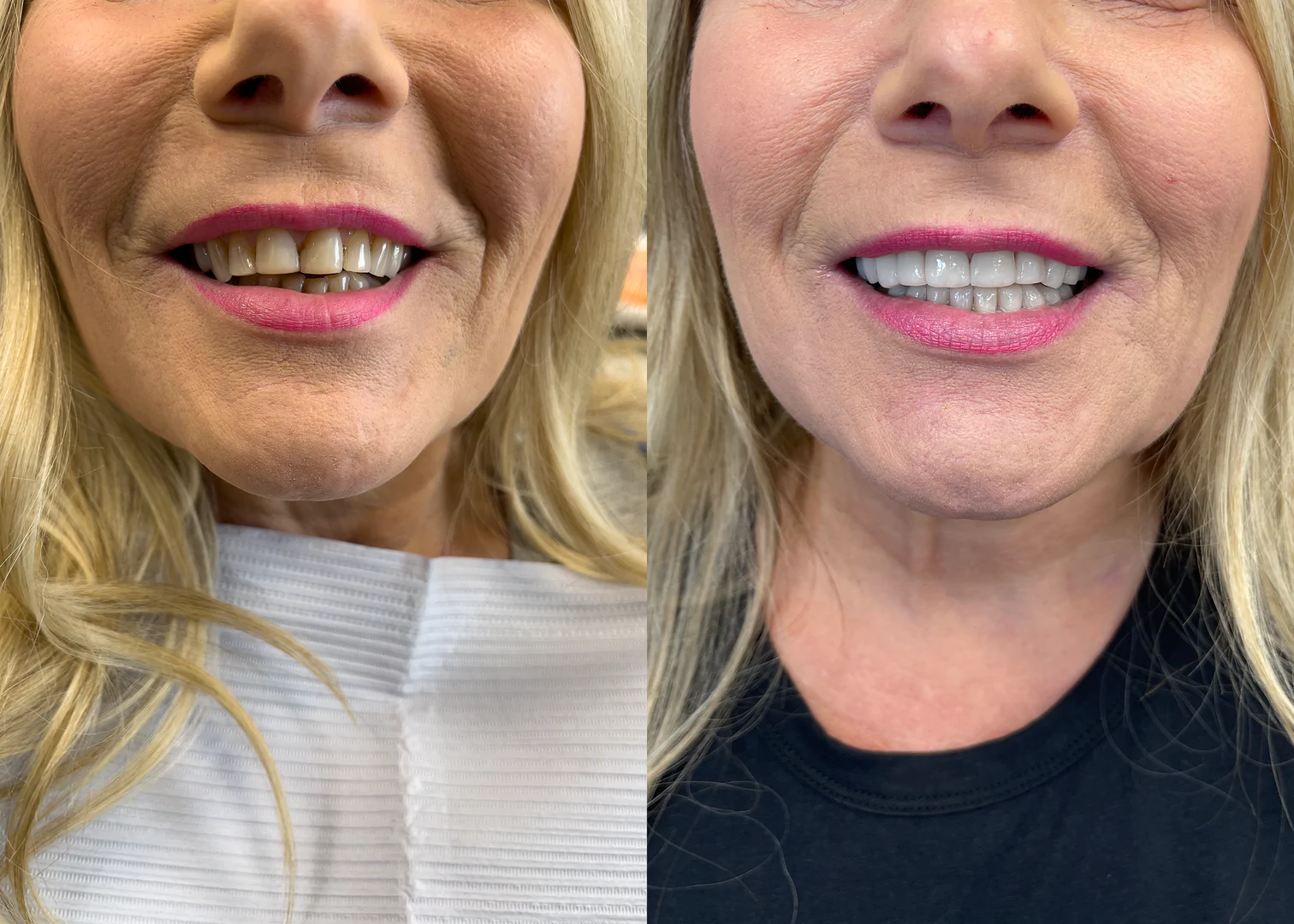 Before - After Image