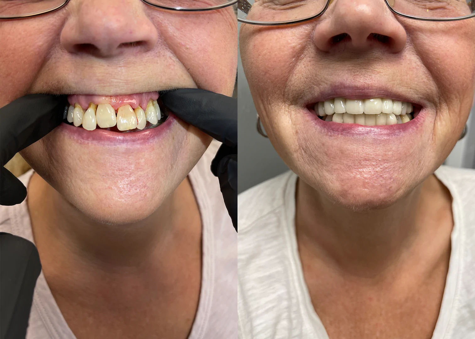 Before - After Image