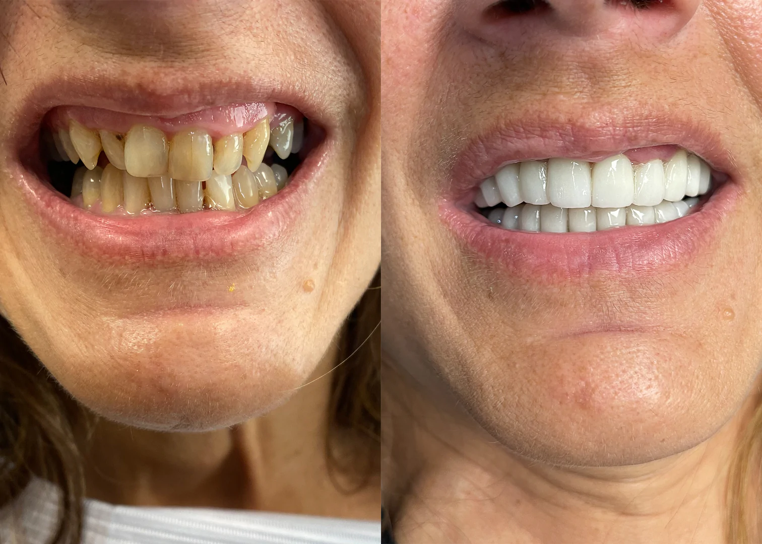 Before - After Image