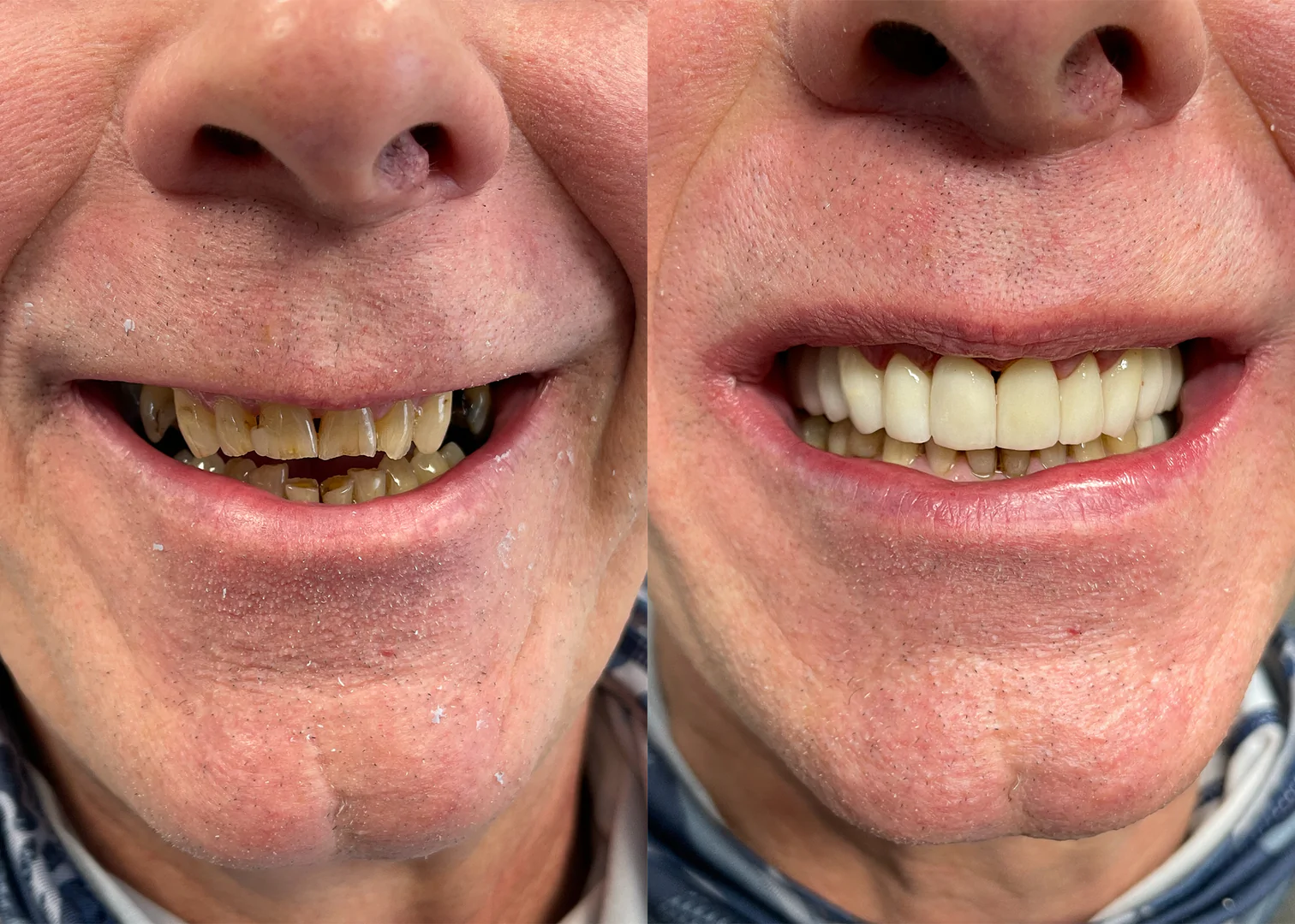 Before - After Image