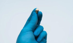 What To Expect During A Tooth Extraction?