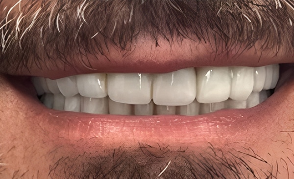 Close-up of a man's smile displaying white, straight teeth and healthy gums.