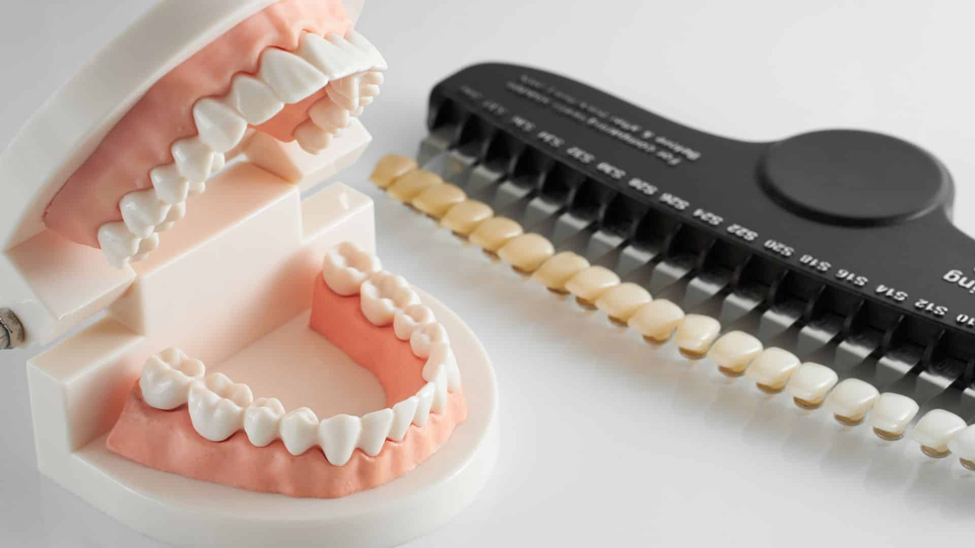 Featured image for “Top Foods And Drinks To Avoid After Teeth Whitening”