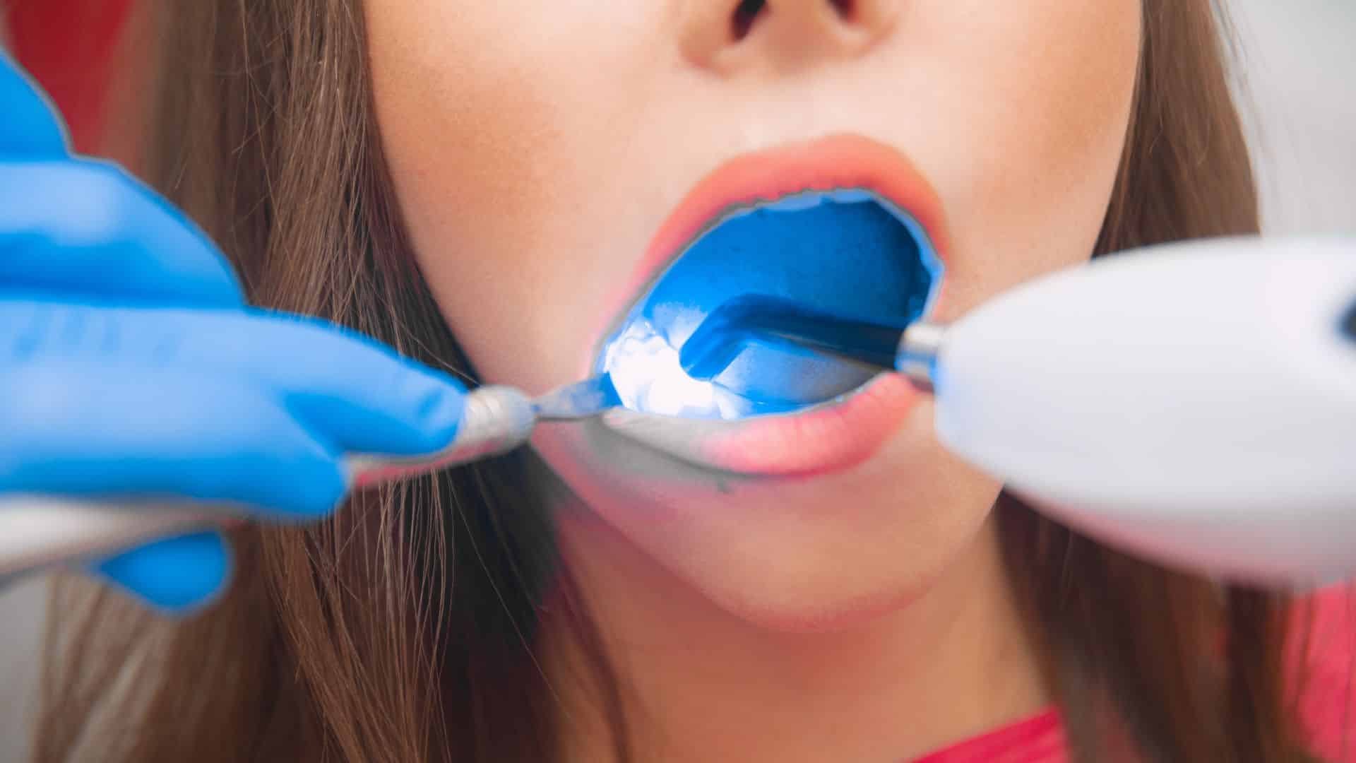 Featured image for “Restorative Dentistry in Sharpsville: Regain Your Dental Health”