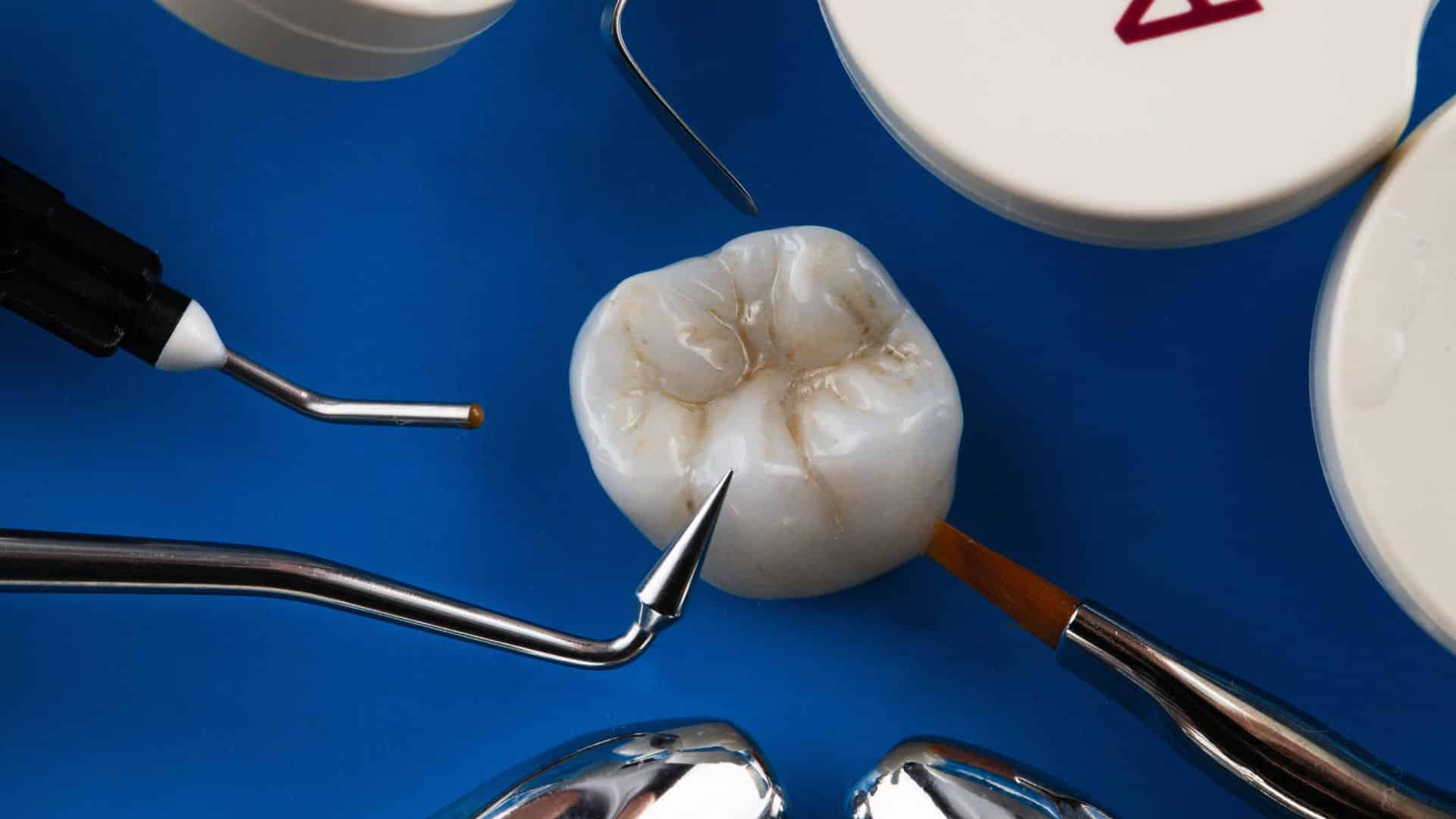 Featured image for “Regaining Your Smile: All You Need to Know About Dental Crowns in Sharpsville”