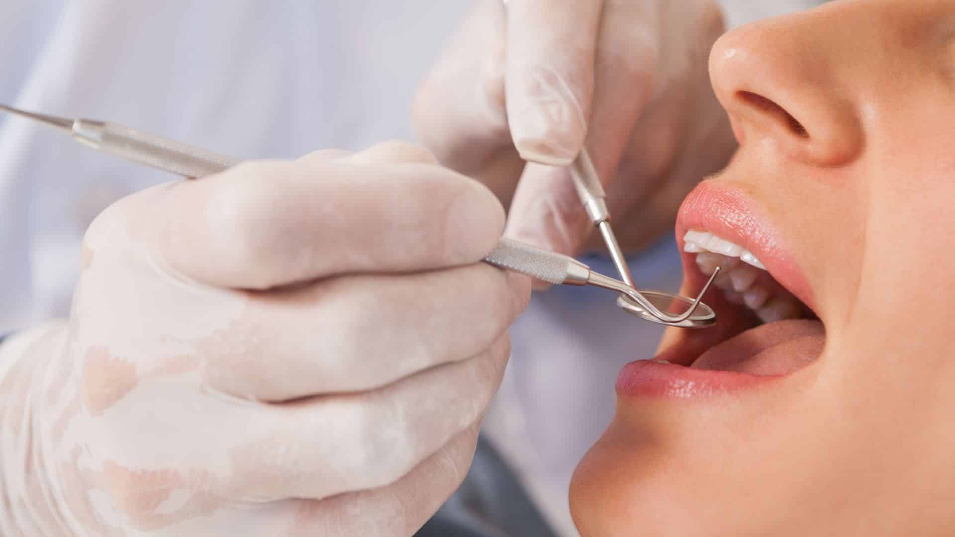 Featured image for “Your Smile Superhero: The Essential Guide to General Dentists”