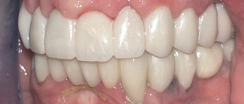 Close-up view of healthy white teeth showing proper dental alignment and oral health.