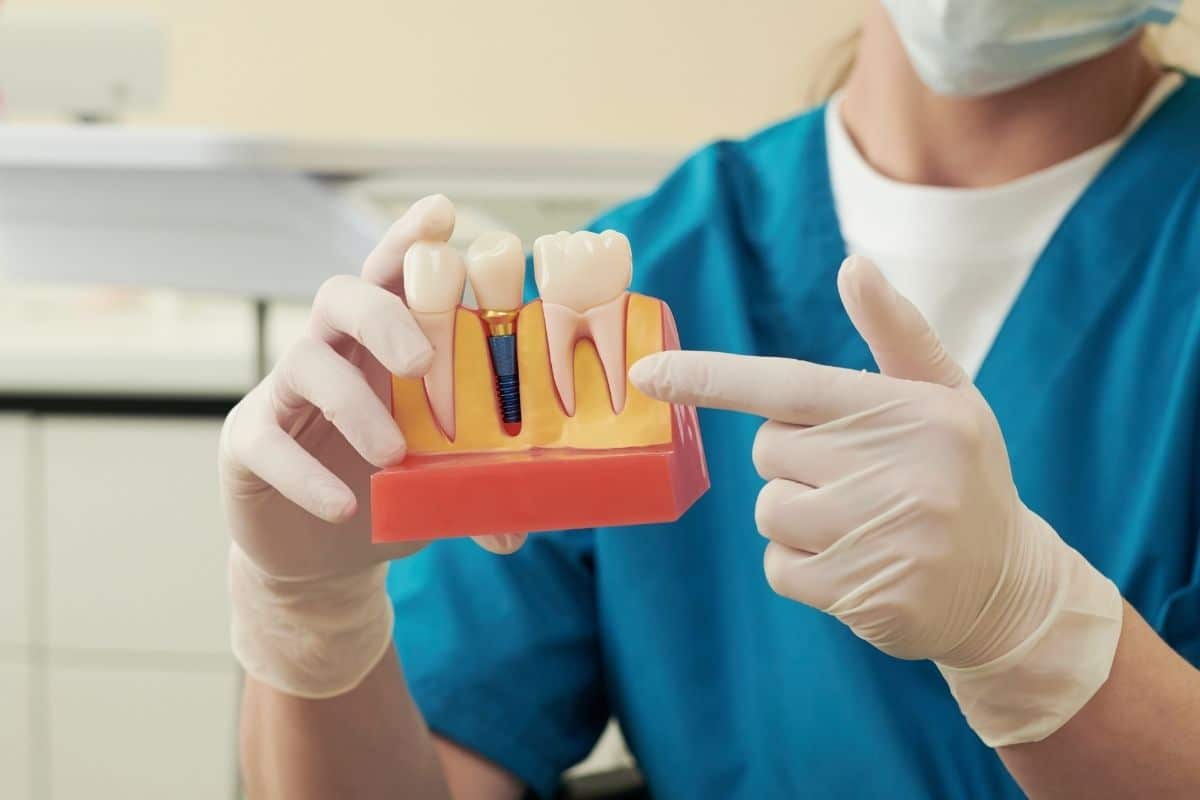 Featured image for “How Can Daily Care Keep Dental Implants Healthy Long Term?”